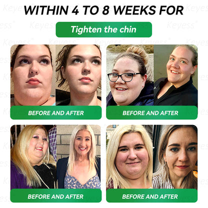 𝐎𝐟𝐟𝐢𝐜𝐢𝐚𝐥 𝐒𝐭𝐨𝐫𝐞 |𝐊𝒆𝒚𝒆ss® 👍 𝑮𝑳𝑷-1 9-𝒊𝒏-1 𝑯𝒆𝒂𝒍𝒕𝒉 𝑶𝒓𝒂𝒍 𝑳𝒊𝒒𝒖𝒊𝒅（𝐎𝐧𝐥𝐲 𝐨𝐧𝐜𝐞 𝐚 𝐝𝐚𝐲, 𝐰𝐢𝐭𝐡 𝐯𝐢𝐬𝐢𝐛𝐥𝐞 𝐫𝐞𝐬𝐮𝐥𝐭𝐬 𝐢𝐧 𝐣𝐮𝐬𝐭 𝟕 𝐝𝐚𝐲𝐬 — 𝐬𝐮𝐩𝐩𝐨𝐫𝐭𝐬 𝐡𝐞𝐚𝐥𝐭𝐡 𝐜𝐨𝐧𝐜𝐞𝐫𝐧𝐬 𝐬𝐮𝐜𝐡 𝐚𝐬 𝐨𝐛𝐞𝐬𝐢𝐭𝐲, 𝐥𝐨𝐨𝐬𝐞 𝐬𝐤𝐢𝐧, 𝐜𝐚𝐫𝐝𝐢𝐨𝐯𝐚𝐬𝐜𝐮𝐥𝐚𝐫 𝐢𝐬𝐬𝐮𝐞𝐬, 𝐝𝐢𝐚𝐛𝐞𝐭𝐞𝐬, 𝐠𝐮𝐭 𝐡𝐞𝐚𝐥𝐭𝐡, 𝐚𝐧𝐝 𝐣𝐨𝐢𝐧𝐭 𝐢𝐧𝐟𝐥𝐚𝐦𝐦𝐚𝐭𝐢𝐨𝐧）