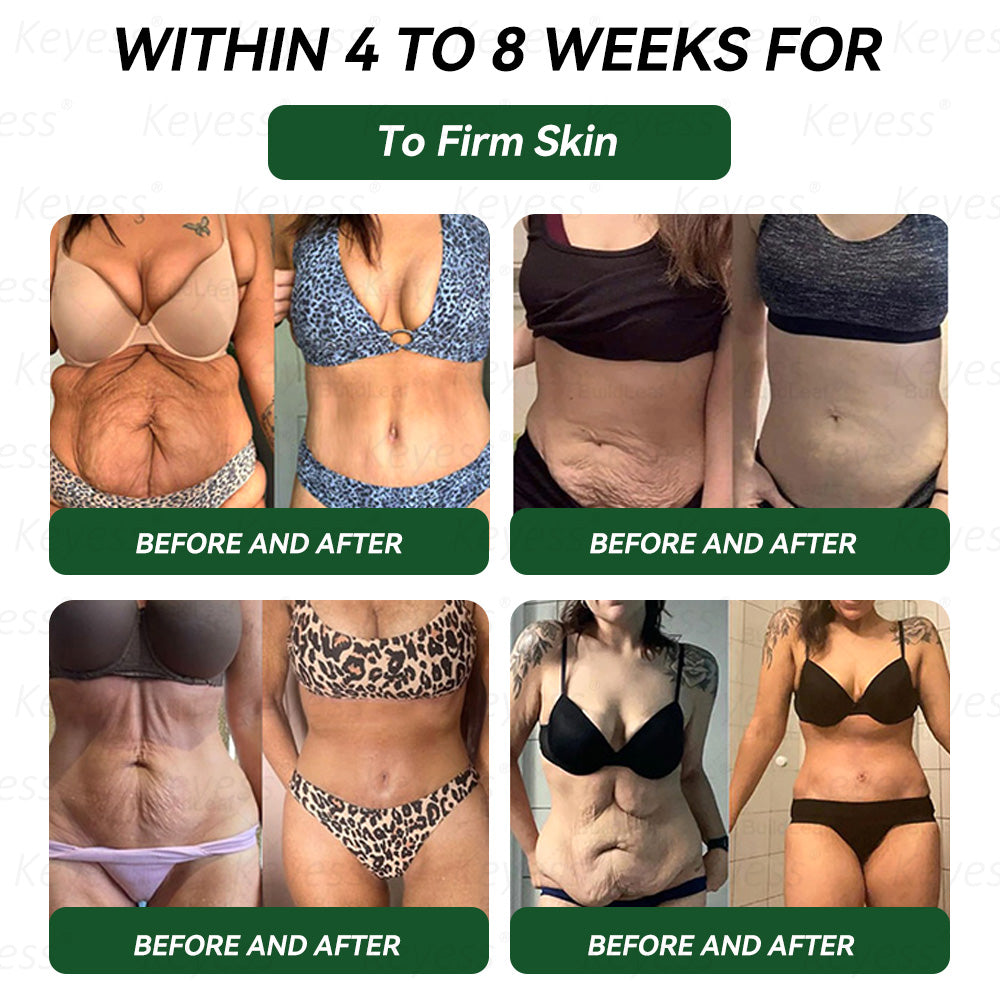 𝐎𝐟𝐟𝐢𝐜𝐢𝐚𝐥 𝐒𝐭𝐨𝐫𝐞 |𝐊𝒆𝒚𝒆ss® 👍 𝑮𝑳𝑷-1 9-𝒊𝒏-1 𝑯𝒆𝒂𝒍𝒕𝒉 𝑶𝒓𝒂𝒍 𝑳𝒊𝒒𝒖𝒊𝒅（𝐎𝐧𝐥𝐲 𝐨𝐧𝐜𝐞 𝐚 𝐝𝐚𝐲, 𝐰𝐢𝐭𝐡 𝐯𝐢𝐬𝐢𝐛𝐥𝐞 𝐫𝐞𝐬𝐮𝐥𝐭𝐬 𝐢𝐧 𝐣𝐮𝐬𝐭 𝟕 𝐝𝐚𝐲𝐬 — 𝐬𝐮𝐩𝐩𝐨𝐫𝐭𝐬 𝐡𝐞𝐚𝐥𝐭𝐡 𝐜𝐨𝐧𝐜𝐞𝐫𝐧𝐬 𝐬𝐮𝐜𝐡 𝐚𝐬 𝐨𝐛𝐞𝐬𝐢𝐭𝐲, 𝐥𝐨𝐨𝐬𝐞 𝐬𝐤𝐢𝐧, 𝐜𝐚𝐫𝐝𝐢𝐨𝐯𝐚𝐬𝐜𝐮𝐥𝐚𝐫 𝐢𝐬𝐬𝐮𝐞𝐬, 𝐝𝐢𝐚𝐛𝐞𝐭𝐞𝐬, 𝐠𝐮𝐭 𝐡𝐞𝐚𝐥𝐭𝐡, 𝐚𝐧𝐝 𝐣𝐨𝐢𝐧𝐭 𝐢𝐧𝐟𝐥𝐚𝐦𝐦𝐚𝐭𝐢𝐨𝐧）