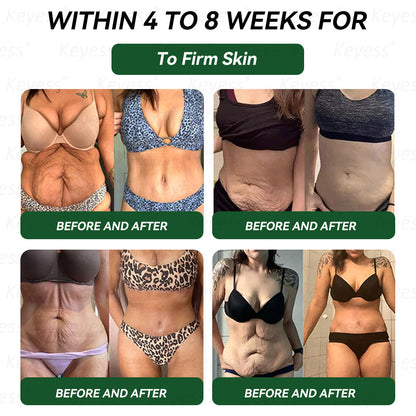 𝐎𝐟𝐟𝐢𝐜𝐢𝐚𝐥 𝐒𝐭𝐨𝐫𝐞 |𝐊𝒆𝒚𝒆ss® 👍 𝑮𝑳𝑷-1 9-𝒊𝒏-1 𝑯𝒆𝒂𝒍𝒕𝒉 𝑶𝒓𝒂𝒍 𝑳𝒊𝒒𝒖𝒊𝒅（𝐎𝐧𝐥𝐲 𝐨𝐧𝐜𝐞 𝐚 𝐝𝐚𝐲, 𝐰𝐢𝐭𝐡 𝐯𝐢𝐬𝐢𝐛𝐥𝐞 𝐫𝐞𝐬𝐮𝐥𝐭𝐬 𝐢𝐧 𝐣𝐮𝐬𝐭 𝟕 𝐝𝐚𝐲𝐬 — 𝐬𝐮𝐩𝐩𝐨𝐫𝐭𝐬 𝐡𝐞𝐚𝐥𝐭𝐡 𝐜𝐨𝐧𝐜𝐞𝐫𝐧𝐬 𝐬𝐮𝐜𝐡 𝐚𝐬 𝐨𝐛𝐞𝐬𝐢𝐭𝐲, 𝐥𝐨𝐨𝐬𝐞 𝐬𝐤𝐢𝐧, 𝐜𝐚𝐫𝐝𝐢𝐨𝐯𝐚𝐬𝐜𝐮𝐥𝐚𝐫 𝐢𝐬𝐬𝐮𝐞𝐬, 𝐝𝐢𝐚𝐛𝐞𝐭𝐞𝐬, 𝐠𝐮𝐭 𝐡𝐞𝐚𝐥𝐭𝐡, 𝐚𝐧𝐝 𝐣𝐨𝐢𝐧𝐭 𝐢𝐧𝐟𝐥𝐚𝐦𝐦𝐚𝐭𝐢𝐨𝐧）