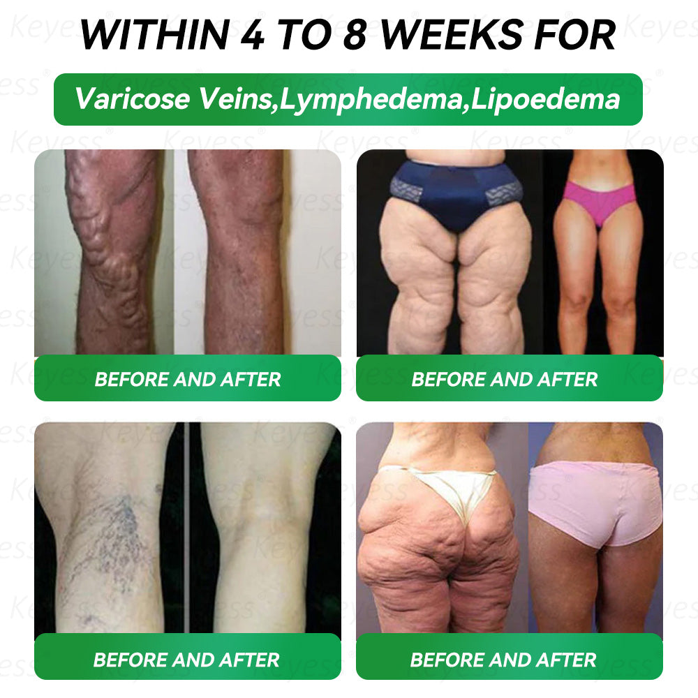 𝐎𝐟𝐟𝐢𝐜𝐢𝐚𝐥 𝐒𝐭𝐨𝐫𝐞 |𝐊𝒆𝒚𝒆ss® 👍 𝑮𝑳𝑷-1 9-𝒊𝒏-1 𝑯𝒆𝒂𝒍𝒕𝒉 𝑶𝒓𝒂𝒍 𝑳𝒊𝒒𝒖𝒊𝒅（𝐎𝐧𝐥𝐲 𝐨𝐧𝐜𝐞 𝐚 𝐝𝐚𝐲, 𝐰𝐢𝐭𝐡 𝐯𝐢𝐬𝐢𝐛𝐥𝐞 𝐫𝐞𝐬𝐮𝐥𝐭𝐬 𝐢𝐧 𝐣𝐮𝐬𝐭 𝟕 𝐝𝐚𝐲𝐬 — 𝐬𝐮𝐩𝐩𝐨𝐫𝐭𝐬 𝐡𝐞𝐚𝐥𝐭𝐡 𝐜𝐨𝐧𝐜𝐞𝐫𝐧𝐬 𝐬𝐮𝐜𝐡 𝐚𝐬 𝐨𝐛𝐞𝐬𝐢𝐭𝐲, 𝐥𝐨𝐨𝐬𝐞 𝐬𝐤𝐢𝐧, 𝐜𝐚𝐫𝐝𝐢𝐨𝐯𝐚𝐬𝐜𝐮𝐥𝐚𝐫 𝐢𝐬𝐬𝐮𝐞𝐬, 𝐝𝐢𝐚𝐛𝐞𝐭𝐞𝐬, 𝐠𝐮𝐭 𝐡𝐞𝐚𝐥𝐭𝐡, 𝐚𝐧𝐝 𝐣𝐨𝐢𝐧𝐭 𝐢𝐧𝐟𝐥𝐚𝐦𝐦𝐚𝐭𝐢𝐨𝐧）