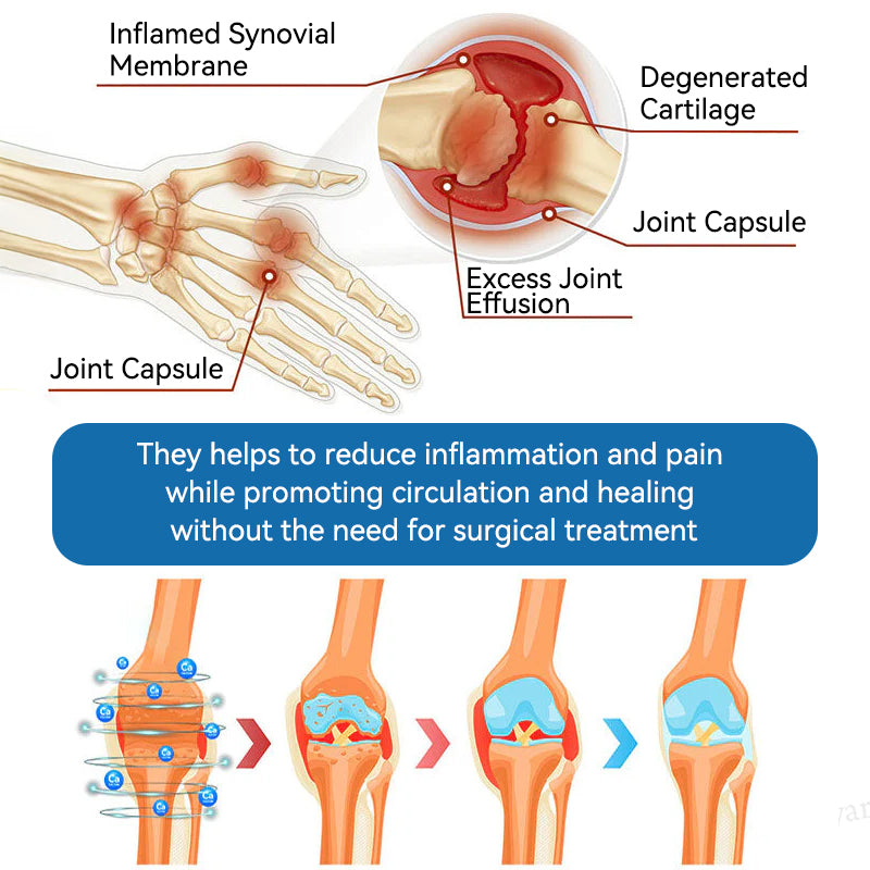 𝐎𝐟𝐟𝐢𝐜𝐢𝐚𝐥 𝐒𝐭𝐨𝐫𝐞 | 𝑷𝐢𝐜𝐝𝐨® 👍𝖡𝖯𝖢-157 Joint Healing Cream🦴Treats Arthritis, Neuropathy, Rheumatism, Sports Injuries & More