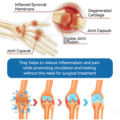 𝐎𝐟𝐟𝐢𝐜𝐢𝐚𝐥 𝐒𝐭𝐨𝐫𝐞 | 𝑷𝐢𝐜𝐝𝐨® 👍𝖡𝖯𝖢-157 Joint Healing Cream🦴Treats Arthritis, Neuropathy, Rheumatism, Sports Injuries & More