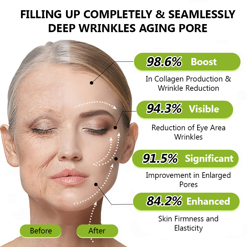 ✅Regain youthful skin nown 👩‍⚕️🎁 STDEI® BOTOX & VITA A RETINOL SHOT Wrinkle Lift Tightening Cream