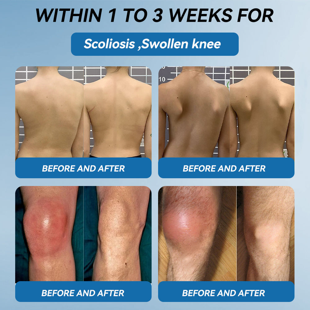 𝐎𝐟𝐟𝐢𝐜𝐢𝐚𝐥 𝐒𝐭𝐨𝐫𝐞 | 𝑷𝐢𝐜𝐝𝐨® 👍𝖡𝖯𝖢-157 Joint Healing Cream🦴Treats Arthritis, Neuropathy, Rheumatism, Sports Injuries & More