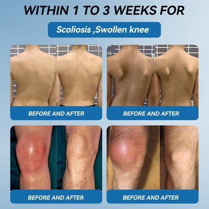 𝐎𝐟𝐟𝐢𝐜𝐢𝐚𝐥 𝐒𝐭𝐨𝐫𝐞 | 𝑷𝐢𝐜𝐝𝐨® 👍𝖡𝖯𝖢-157 Joint Healing Cream🦴Treats Arthritis, Neuropathy, Rheumatism, Sports Injuries & More