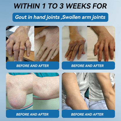 𝐎𝐟𝐟𝐢𝐜𝐢𝐚𝐥 𝐒𝐭𝐨𝐫𝐞 | 𝑷𝐢𝐜𝐝𝐨® 👍𝖡𝖯𝖢-157 Joint Healing Cream🦴Treats Arthritis, Neuropathy, Rheumatism, Sports Injuries & More