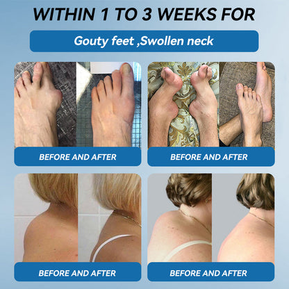 𝐎𝐟𝐟𝐢𝐜𝐢𝐚𝐥 𝐒𝐭𝐨𝐫𝐞 | 𝑷𝐢𝐜𝐝𝐨® 👍𝖡𝖯𝖢-157 Joint Healing Cream🦴Treats Arthritis, Neuropathy, Rheumatism, Sports Injuries & More