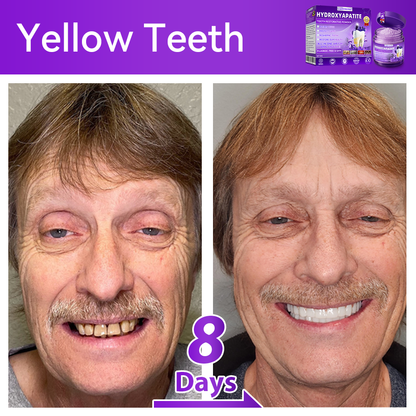 Official Store💕｜𝑫𝒐𝒓𝒎𝒐𝒓𝒏𝒂® Hydroxyapatite Tooth Repair Powder🦷 (New Year Oral Care Promotion)