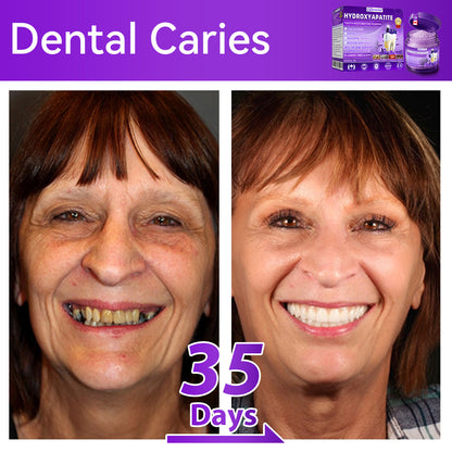 𝑂𝑓𝑓𝑖𝑐𝑖𝑎𝑙 𝑆𝑡𝑜𝑟𝑒🌌|𝐷𝑜𝑟𝑚𝑜𝑟𝑛𝑎® 𝐻𝑦𝑑𝑟𝑜𝑥𝑦𝑎𝑝𝑎𝑡𝑖𝑡𝑒 𝑇𝑜𝑜𝑡ℎ 𝑅𝑒𝑠𝑡𝑜𝑟𝑎𝑡𝑖𝑣𝑒 𝑃𝑜𝑤𝑑𝑒𝑟🦷（Last 30 minutes of the limited-time offer!）