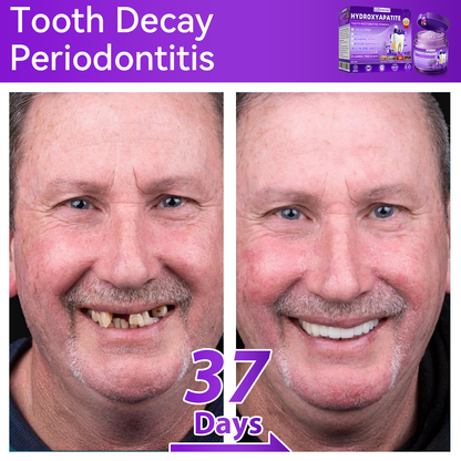 Official Store💕｜𝑫𝒐𝒓𝒎𝒐𝒓𝒏𝒂® Hydroxyapatite Tooth Repair Powder🦷 (New Year Oral Care Promotion)