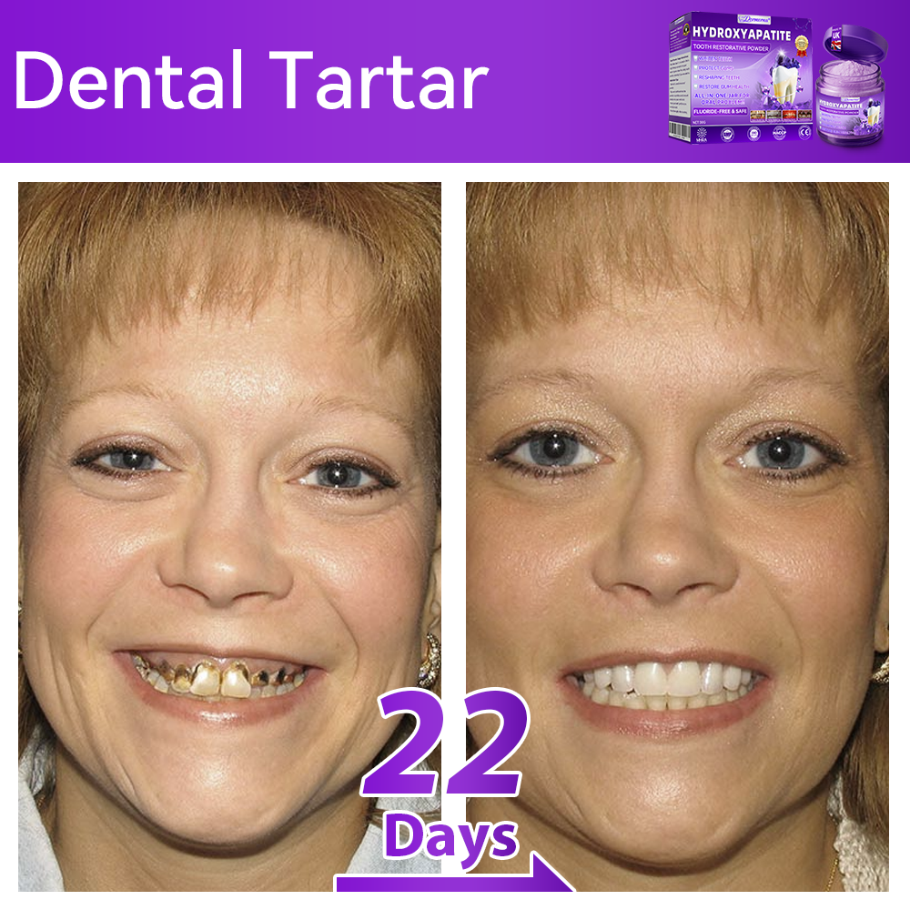 Official Store💕｜𝑫𝒐𝒓𝒎𝒐𝒓𝒏𝒂® Hydroxyapatite Tooth Repair Powder🦷 (New Year Oral Care Promotion)