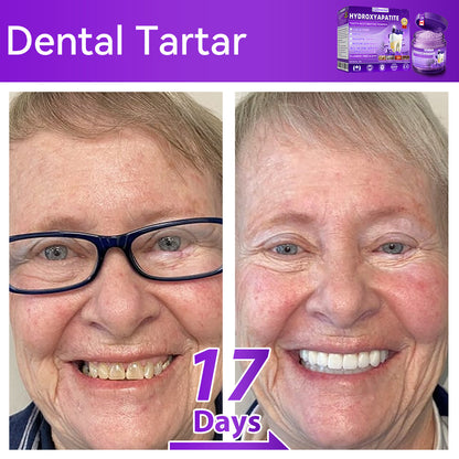 𝑂𝑓𝑓𝑖𝑐𝑖𝑎𝑙 𝑆𝑡𝑜𝑟𝑒🌌|𝐷𝑜𝑟𝑚𝑜𝑟𝑛𝑎® 𝐻𝑦𝑑𝑟𝑜𝑥𝑦𝑎𝑝𝑎𝑡𝑖𝑡𝑒 𝑇𝑜𝑜𝑡ℎ 𝑅𝑒𝑠𝑡𝑜𝑟𝑎𝑡𝑖𝑣𝑒 𝑃𝑜𝑤𝑑𝑒𝑟🦷（Last 30 minutes of the limited-time offer!）