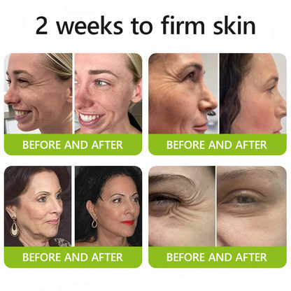 ✅Regain youthful skin nown 👩‍⚕️🎁 STDEI® BOTOX & VITA A RETINOL SHOT Wrinkle Lift Tightening Cream