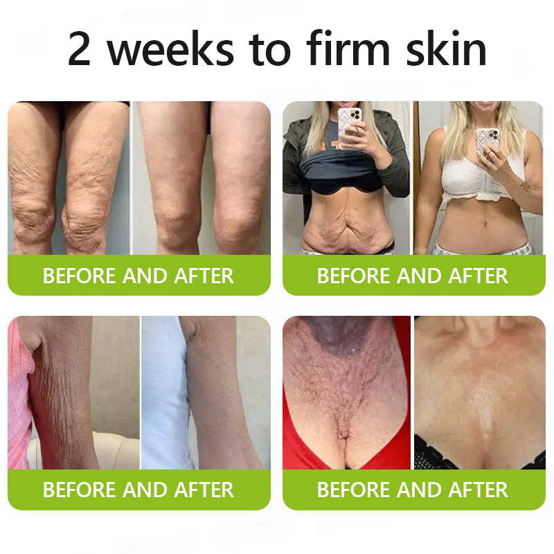 ✅Regain youthful skin nown 👩‍⚕️🎁 STDEI® BOTOX & VITA A RETINOL SHOT Wrinkle Lift Tightening Cream