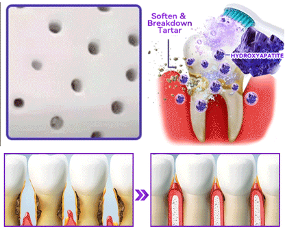 𝑂𝑓𝑓𝑖𝑐𝑖𝑎𝑙 𝑆𝑡𝑜𝑟𝑒🌌|𝐷𝑜𝑟𝑚𝑜𝑟𝑛𝑎® 𝐻𝑦𝑑𝑟𝑜𝑥𝑦𝑎𝑝𝑎𝑡𝑖𝑡𝑒 𝑇𝑜𝑜𝑡ℎ 𝑅𝑒𝑠𝑡𝑜𝑟𝑎𝑡𝑖𝑣𝑒 𝑃𝑜𝑤𝑑𝑒𝑟🦷（Last 30 minutes of the limited-time offer!）