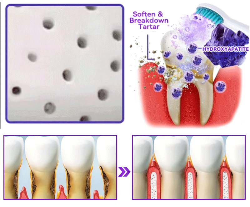 Official Store💕｜𝑫𝒐𝒓𝒎𝒐𝒓𝒏𝒂® Hydroxyapatite Tooth Repair Powder🦷 (New Year Oral Care Promotion)